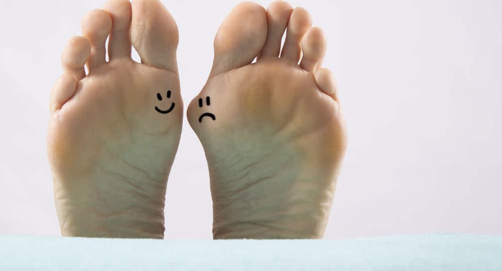 How to Know You Are Getting Bunions: Early Signs, Causes, and Prevention